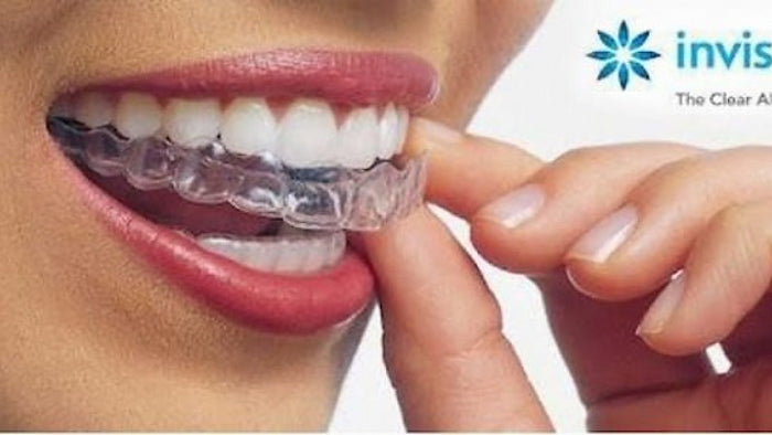 Invisalign - Romsey Dental