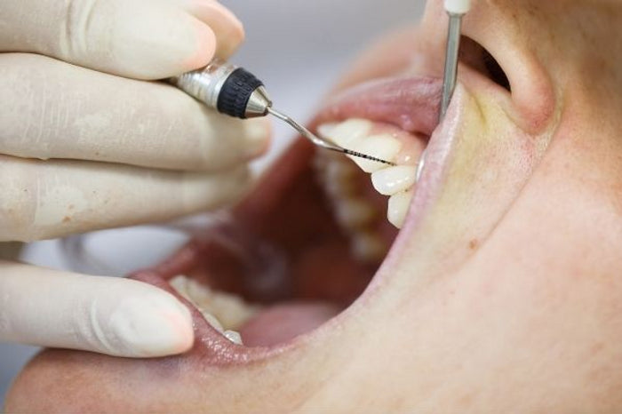 Gum (Periodontal) Treatment - Romsey Family Dental Care